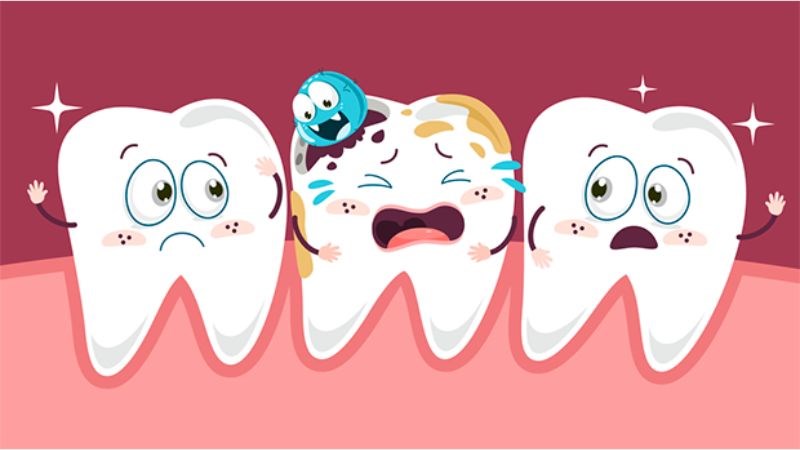 Đường sucrose là nguyên nhân gây sâu răng